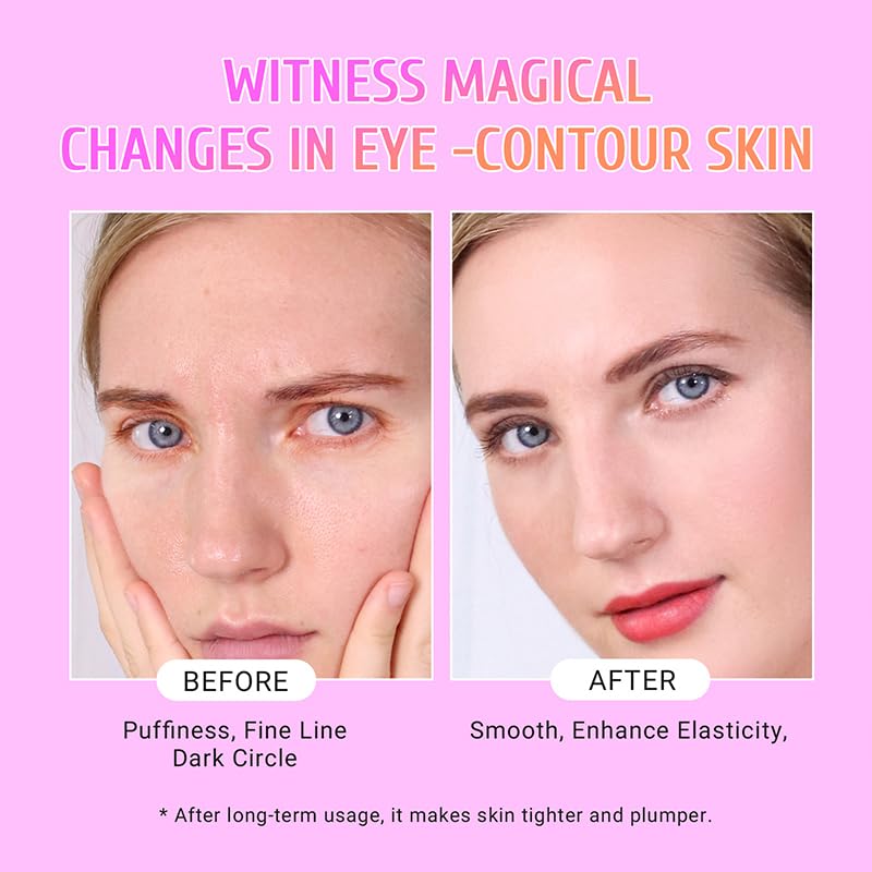 Merry & Bright Under Eye Patches Gold and Hyaluronic Acid for puffy eyes