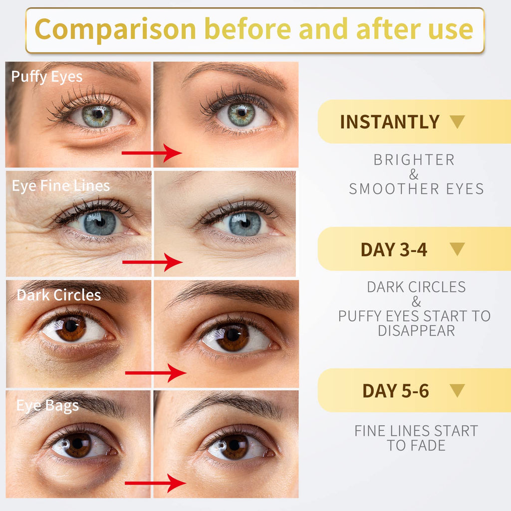 Merry & Bright Gold Under Eye Patches – Puffy Eyes, Dark Circles & Hydration