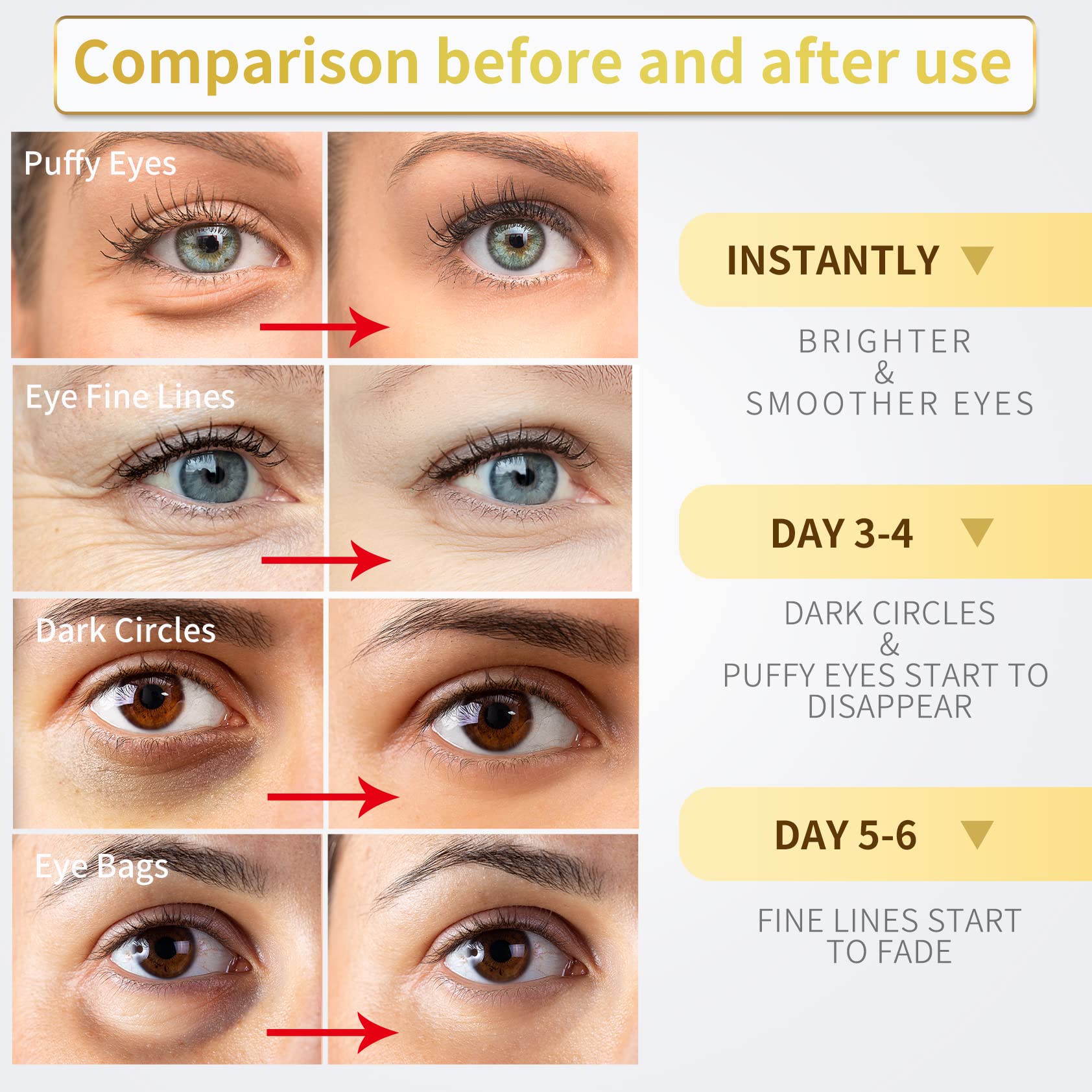 Merry & Bright Gold Under Eye Patches – Puffy Eyes, Dark Circles & Hydration